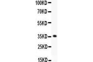 Anti- KLF6 antibody, Western blotting All lanes: Anti KLF6  at 0. (KLF6 抗体  (AA 38-205))