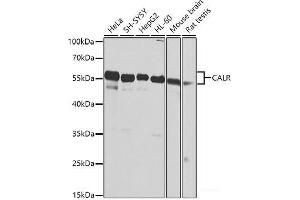 Western blot analysis of extracts of various cell lines using CALR Polyclonal Antibody at dilution of 1:1000. (Calreticulin 抗体)