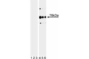 Western blot analysis of SLP-76 (pY113) in human T leukemia. (LCP2 抗体  (pTyr113))