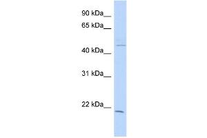WB Suggested Anti-CIB3 Antibody Titration: 0. (CIB3 抗体  (N-Term))