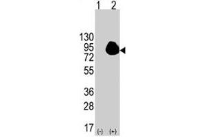 Western blot analysis of RPS6KA1 (arrow) using RPS6KA1 polyclonal antibody . (RPS6KA1 抗体  (Ser732))