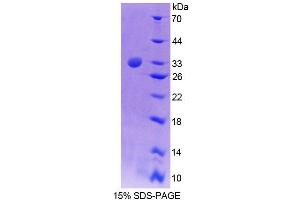 SDS-PAGE (SDS) image for Tec Protein Tyrosine Kinase (TEC) (AA 369-622) protein (His tag) (ABIN6239125)