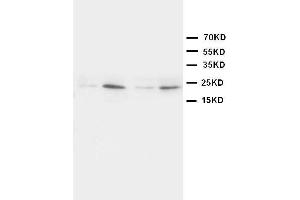 Anti-HMGB4 antibody, Western blotting Lane 1: Rat Brain Tissue Lysate Lane 2: Rat Testis Tissue Lysate Lane 3: JURKAT Cell Lysate Lane 4:  Cell Lysate (HMGB4 抗体  (N-Term))