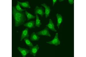 Immunofluorescence analysis of A549 cell using CDC5L antibody. (CDC5L 抗体)