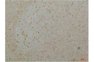 Immunohistochemistry (IHC) analysis of paraffin-embedded Mouse Brain Tissue using Cav1. (CACNA1D 抗体)