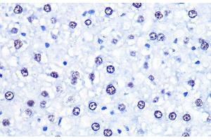 Immunohistochemistry of paraffin-embedded Rat liver using CHD4 Polyclonal Antibody at dilution of 1:100 (40x lens). (CHD4 抗体)