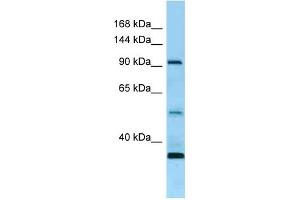 Western Blotting (WB) image for anti-Receptor Tyrosine Kinase-Like Orphan Receptor 1 (ROR1) (N-Term) antibody (ABIN2789669) (ROR1 抗体  (N-Term))