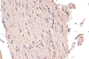 Immunohistochemistry (IHC) image for anti-Heat Shock 10kDa Protein 1 (Chaperonin 10) (HSPE1) antibody (ABIN7267567)