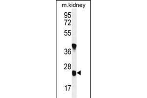 U119B Antibody (C-term) (ABIN654979 and ABIN2844619) western blot analysis in mouse kidney tissue lysates (35 μg/lane). (UNC119B 抗体  (C-Term))