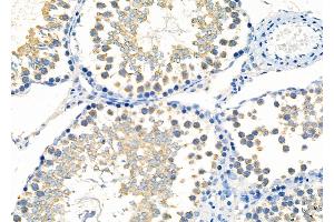 ABIN6261296 and ABIN6277276 at 1/100 staining Rat testis tissue by IHC-P. (DIABLO 抗体  (C-Term))