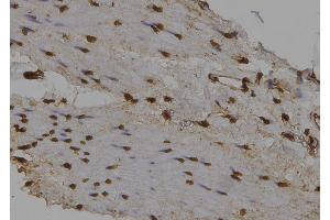 ABIN6276493 at 1/100 staining Human gastric tissue by IHC-P. (NUAK2 抗体  (Internal Region))