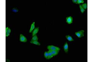 Immunofluorescent analysis of HepG2 cells using ABIN7157794 at dilution of 1:100 and Alexa Fluor 488-congugated AffiniPure Goat Anti-Rabbit IgG(H+L) (Lactate Dehydrogenase A 抗体  (AA 5-323))