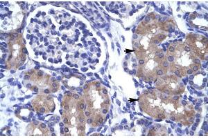 Human kidney (ASCL1 抗体  (N-Term))