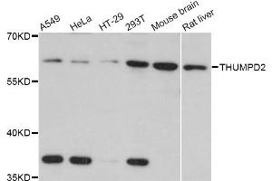 Western blot analysis of extracts of various cell lines, using THUMPD2 Antibody (ABIN4905417) at 1:3000 dilution. (THUMPD2 抗体)