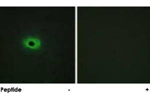Immunofluorescence analysis of HeLa cells, using SDC4 polyclonal antibody . (SDC4 抗体  (Ser179))