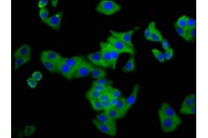Immunofluorescence staining of HepG2 cells with ABIN7148726 at 1: 133, counter-stained with DAPI. (CSMD3 抗体  (AA 233-380))