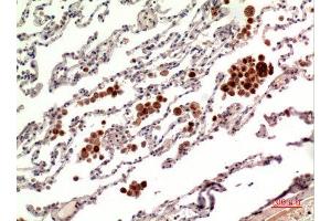 Immunohistochemistry (IHC) analysis of paraffin-embedded Human Lung, antibody was diluted at 1:100. (RANKL 抗体  (C-Term))