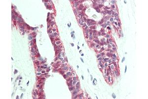 Anti-PTPLA antibody IHC staining of human breast.