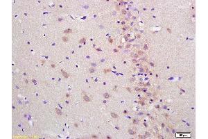 Formalin-fixed and paraffin embedded rat brain labeled with Anti-Cytosine deaminase Polyclonal Antibody, Unconjugated (ABIN682138) at 1:200 followed by conjugation to the secondary antibody and DAB staining (Cytosine Deaminase 抗体)