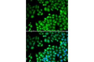 Immunofluorescence analysis of U2OS cells using KMT2E antibody (ABIN5973619). (MLL5/KMT2E 抗体)