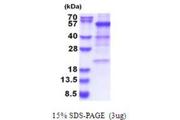 GLUD1 Protein (AA 54-558) (His tag)