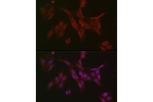 Immunofluorescence (IF) image for anti-Receptor-Interacting serine-threonine Kinase 3 (RIPK3) (AA 1-120) antibody (ABIN6146964)