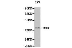 Western Blotting (WB) image for anti-Sjogren Syndrome Antigen B (SSB) antibody (ABIN1874948) (SSB 抗体)