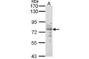 Western Blotting (WB) image for anti-Solute Carrier Family 5 (Sodium/glucose Cotransporter), Member 1 (SLC5A1) (Center) antibody (ABIN2856095)