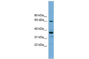 WB Suggested Anti-TH1L Antibody Titration: 0. (TH1-Like 抗体  (N-Term))