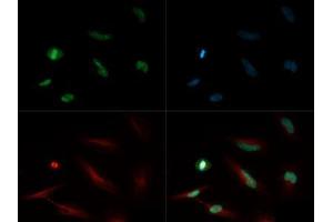 Fluorescence Microscopy (FM) image for anti-Histone H4 (meLys20) antibody (ABIN5706797)