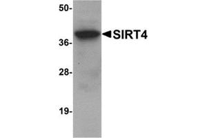 Western blot analysis of SIRT4 in human liver tissue lysate with SIRT4 antibody at 1 μg/ml. (SIRT4 抗体  (N-Term))