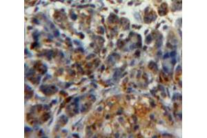 Used in DAB staining on fromalin fixed paraffin-embedded pancreas tissue (PDIA2 抗体  (AA 309-525))