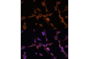 Immunofluorescence analysis of NIH/3T3 cells using UBE2J1 antibody (ABIN7271172) at dilution of 1:100. (UBE2J1 抗体  (AA 1-100))