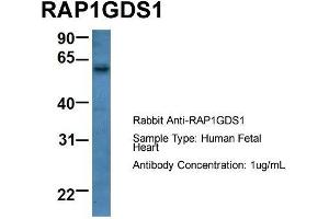 Host: Rabbit  Target Name: RAP1GDS1  Sample Tissue: Human Fetal Heart  Antibody Dilution: 1. (RAP1GDS1 抗体  (Middle Region))