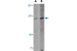 Western blot analysis of BBC3 expression in K-562 cell lysate with BBC3 monoclonal antibody, clone 10D4G7  at (A) 2. (PUMA 抗体  (AA 76-170))