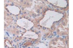 IHC-P analysis of Human Kidney Tissue, with DAB staining. (SLC12A3 抗体  (AA 3-146))