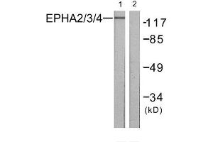 Western Blotting (WB) image for anti-EPH Receptor A2/3/4 (EPHA2/3/4) (Tyr588), (Tyr596) antibody (ABIN1848022) (EPHA2/3/4 抗体  (Tyr588, Tyr596))