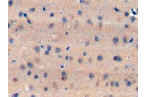 Immunohistochemistry (IHC) image for anti-Notch 1 (NOTCH1) (AA 1919-2079) antibody (ABIN7445663)