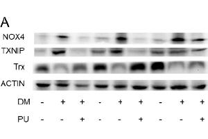 TXNIP 抗体  (AA 1-166)