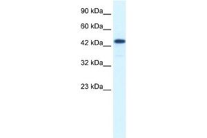 WB Suggested Anti-RCOR3 Antibody Titration:  1. (RCOR3 抗体  (N-Term))