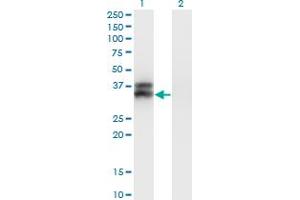 Western Blot analysis of OLIG2 expression in transfected 293T cell line by OLIG2 monoclonal antibody (M05), clone 2A8. (OLIG2 抗体  (AA 2-78))