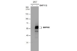 Western Blotting (WB) image for anti-Bone Morphogenetic Protein Receptor, Type IB (BMPR1B) antibody (ABIN2855400)