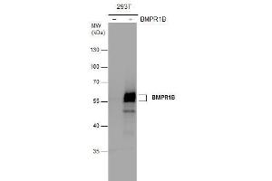 WB Image BMPR1B antibody detects BMPR1B protein by western blot analysis. (BMPR1B 抗体)