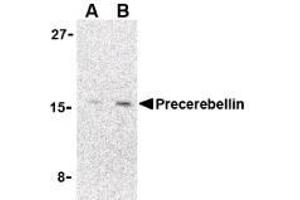 Image no. 1 for anti-Cerebellin 1 Precursor (CBLN1) (C-Term) antibody (ABIN200081) (CBLN1 抗体  (C-Term))