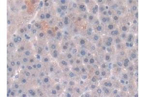 Detection of LEP in Rat Liver Tissue using Polyclonal Antibody to Leptin (LEP) (Leptin 抗体  (AA 22-167))