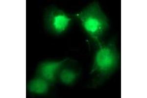 Image no. 2 for anti-Cell Division Cycle 123 Homolog (CDC123) antibody (ABIN1497388)