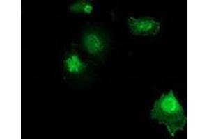 Immunofluorescence (IF) image for anti-Zinc Finger, AN1-Type Domain 2B (ZFAND2B) antibody (ABIN1501809) (ZFAND2B 抗体)