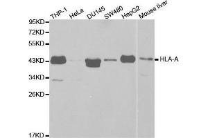 Western blot analysis of extracts of various cell lines, using HLA-A antibody. (HLA-A 抗体  (AA 35-285))