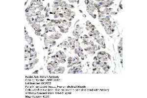 Human Skeletal Muscle (T-Bet 抗体  (Middle Region))