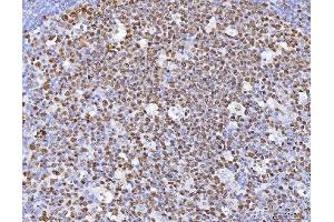 IHC analysis of MCM6 using anti-MCM6 antibody (ABIN7600035). (MCM6 抗体  (AA 14-821))